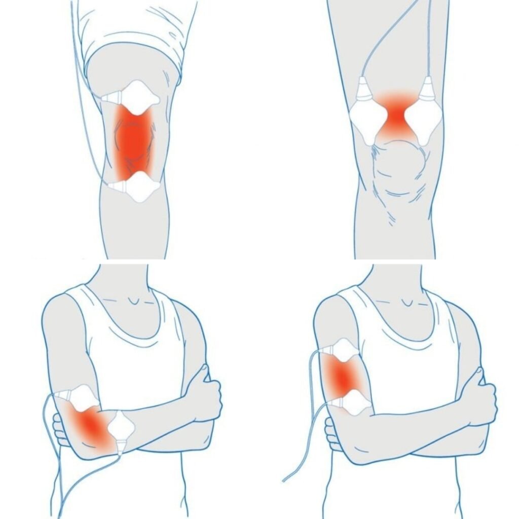 Joint knee elbow and arm